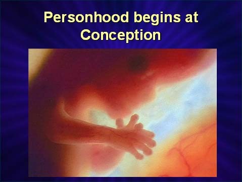 Personhood_Begins_at_Concep
