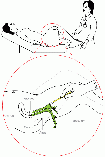 080000-Pap-Test_2