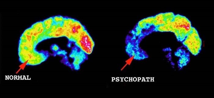 Brain self-regulation in criminal psychopaths